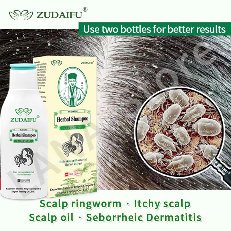 Zudaifu Hair Psoriasis Seborrheic Skin Care Treatment Dermatitis Eczema ...