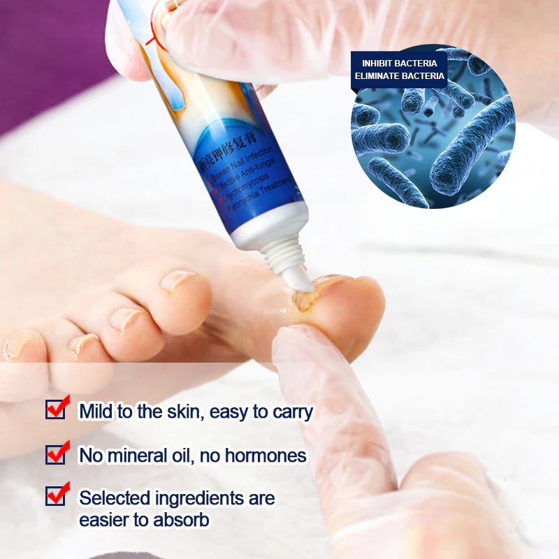 1Pcs Nail Fungus Removal Cream Onychomycosis Fungal Treatment