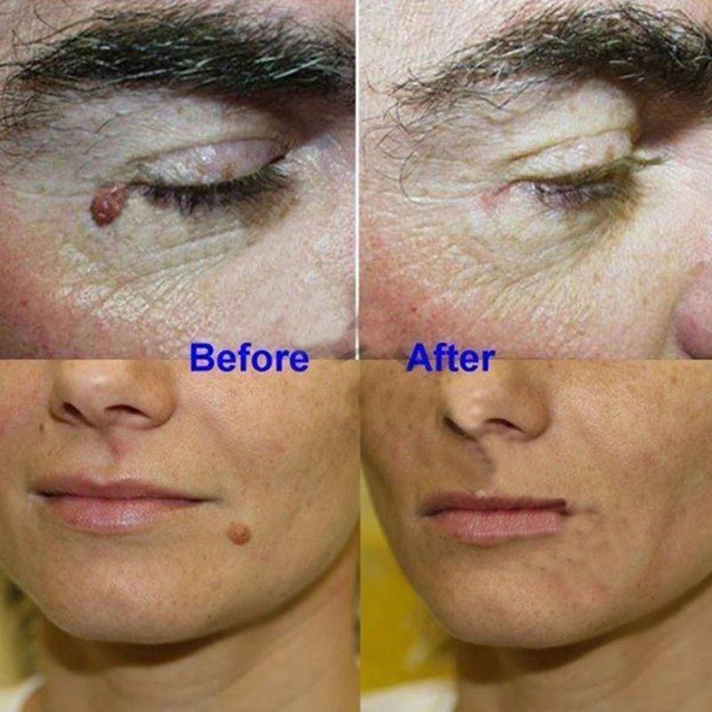 H1512780444ad4674b620f5f7cf223ac4W