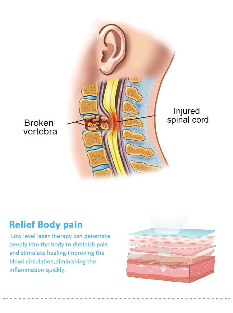 红外颈椎理疗仪_06